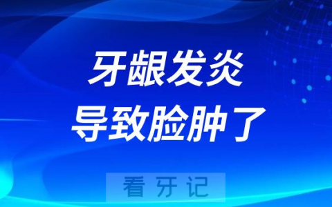 甲流牙龈发炎导致脸肿了怎么办一般几天能好