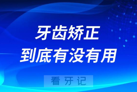 牙齿矫正到底有没有用有什么用