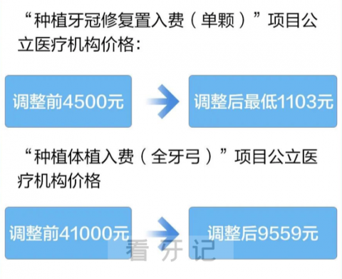 北京种植牙多少钱一颗2023年北京种植牙集采价格来了