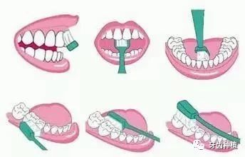 正确的刷牙方式到底是什么样的附图