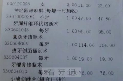 拔牙只要3元是真的假的为什么我花了一千多