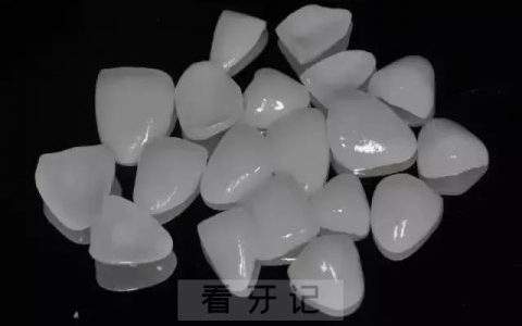 太可怕了全瓷贴面会损害牙齿是真的假的附四大谣言