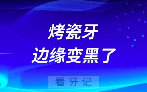 太可怕了烤瓷牙的边缘变黑了会不会有毒附图片