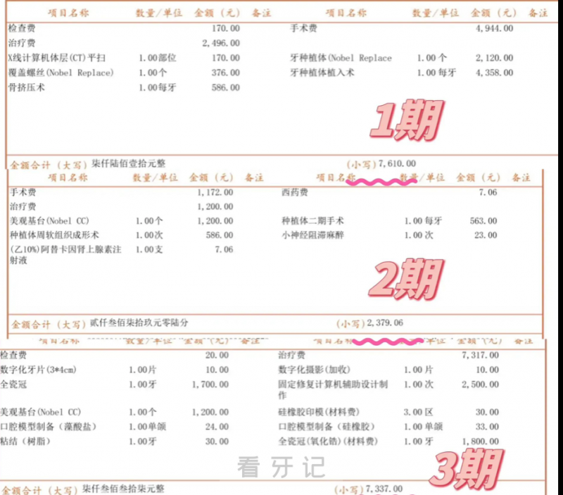 **种牙看牙记**期二期三期费用明细表
