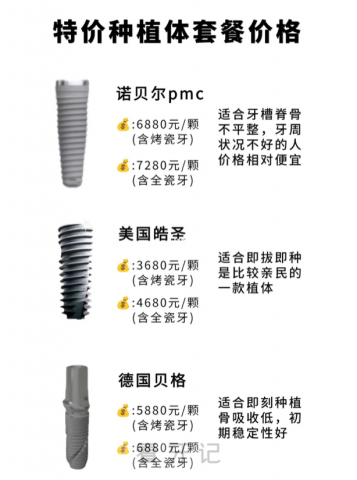 国内某口腔特价种植体套餐价格表2023版
