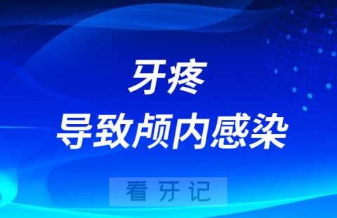 太可怕了牙疼不在意导致颅内感染差点失去生命