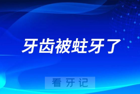 牙齿被蛀牙了一个大洞是不是要拔掉