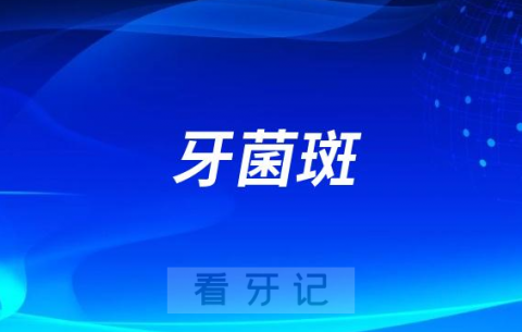 牙菌斑可不可以漱口刷牙刷掉