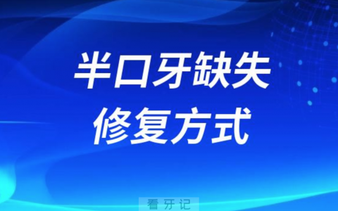半口牙缺失修复方式有哪些