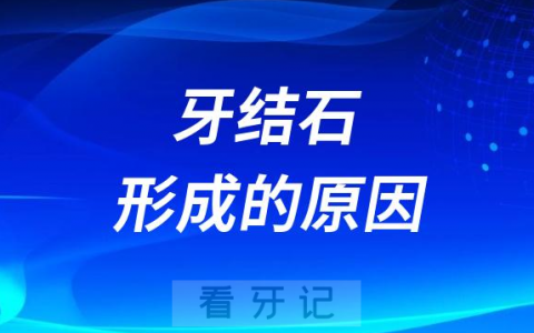 太顽固了牙结石形成的原因到底是什么