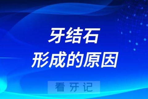 太顽固了牙结石形成的原因到底是什么