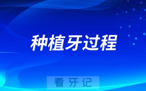 种植牙到底是一个什么样的过程？看完专家介绍大开眼界