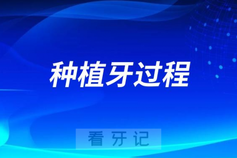 种植牙到底是一个什么样的过程？看完专家介绍大开眼界