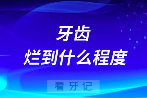 牙齿烂到什么程度就必须要拔牙了附烂牙图片