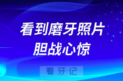 看到磨牙照片后胆战心惊但不后悔做牙贴面