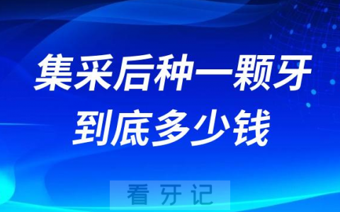 牙医告诉你集采后种一颗牙到底多少钱附计算公式
