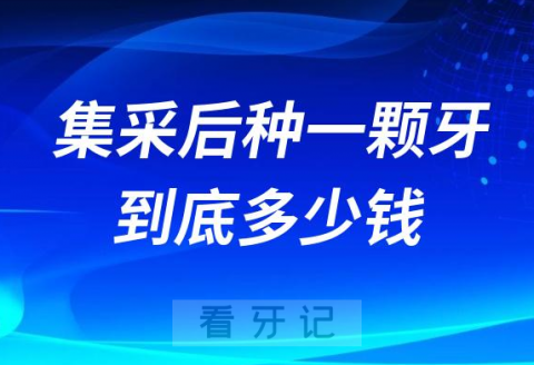 牙医告诉你集采后种一颗牙到底多少钱附计算公式