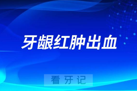 牙龈红肿出血不想洗牙怎么办