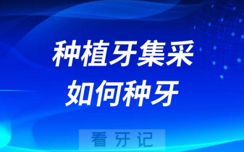 种植牙集采开始后如何选择种植牙