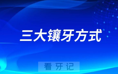 活动牙固定牙种植牙三大镶牙方式哪种最好该镶哪种