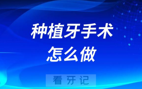 种植牙手术怎么做种牙手术全过程要多长时间
