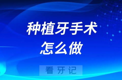 种植牙手术怎么做种牙手术全过程要多长时间