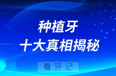 种植牙十大真相揭秘2023版