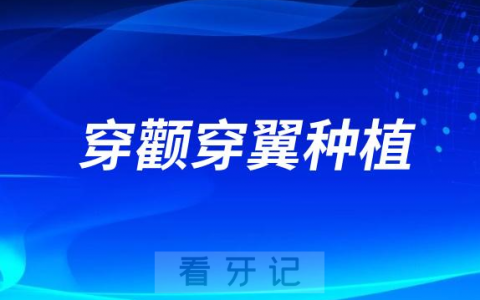 太可怕了穿颧穿翼种植要求及细节揭秘