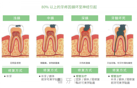 牙疼牙痛到底是不是上火如果不是那是什么