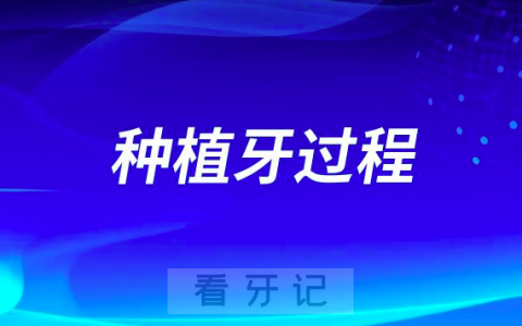 种植牙的过程是怎样的附七大流程步骤