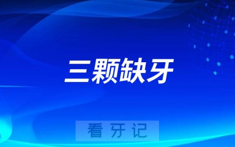 相邻三颗缺牙要种几颗种植牙