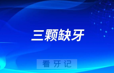 相邻三颗缺牙要种几颗种植牙