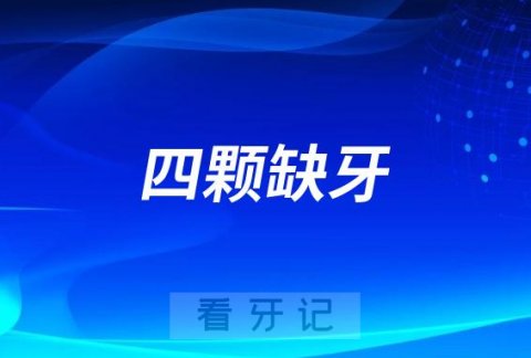 相邻四颗缺牙要种几颗种植牙