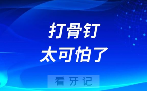 太可怕了是不是矫正医生让你打骨钉