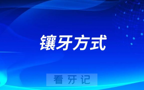 烤瓷牙活动假牙种植牙哪种镶牙最好
