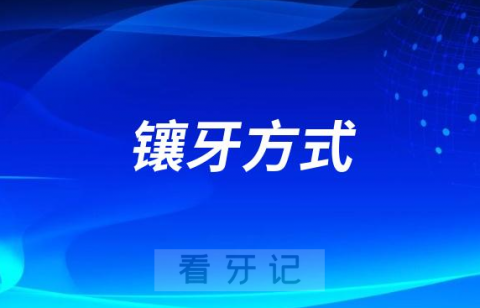 烤瓷牙活动假牙种植牙哪种镶牙最好