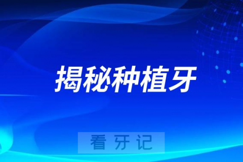 记者揭秘种植牙价格在北京到底降了多少