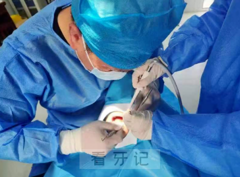 蚌埠市中医医院口腔科做种植牙看牙记