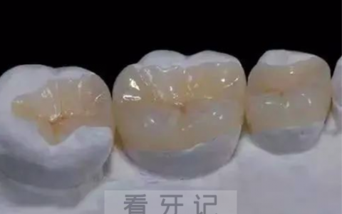 为什么说良心牙医补牙让你选择嵌体修复最全科普来了