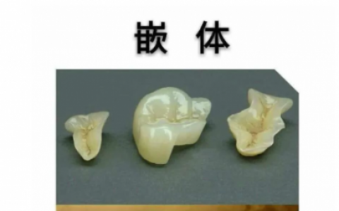 去医院做牙齿做嵌体修复一般多少钱