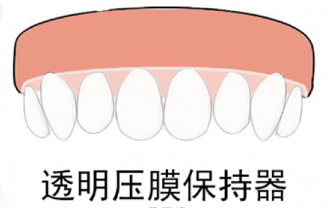 正畸保持器长什么样附图片
