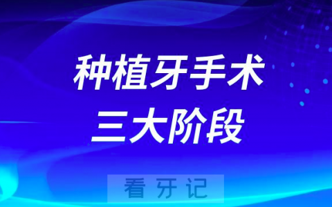 梧州市****种植牙价格出炉附集采政策