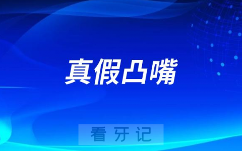 太可怕了凸嘴分真假吗真凸嘴有哪些症状