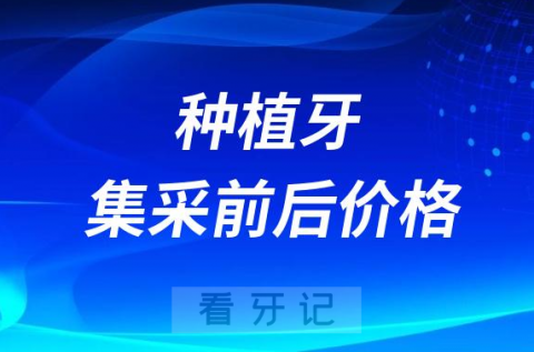 种植牙集采前后降了多少钱附计算攻略