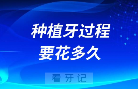 种植牙全部搞完要花多长时间