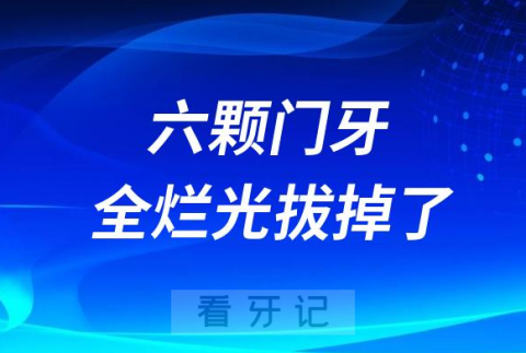 太可怕了19岁学生一口牙齿竟然拔掉8颗折断10颗