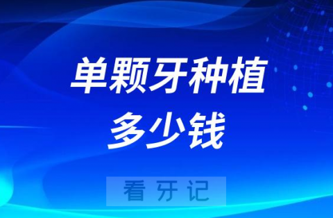 世界各国种植牙品牌单颗牙种植需要多少钱？