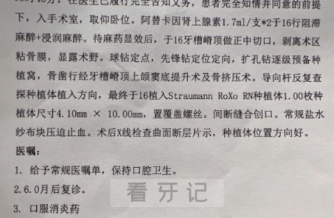 山大口腔做种植牙真实使用感受2023