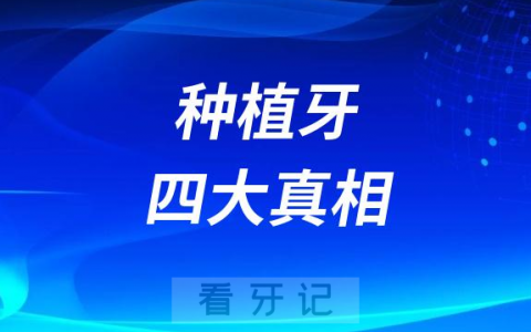 良心医生才会告诉你的四大种植牙真相揭秘