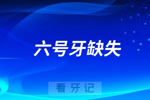 太可怕了6号牙缺失很久了怎么办？种一颗多少钱？